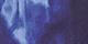 Blue Combo