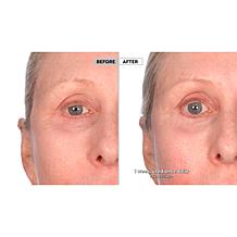 Active Argan 2-pack Resurface Super Size Resurfacing Serum Auto-Ship®