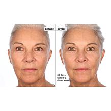 Active Argan Resurface Accelerating Peel Auto-Ship®