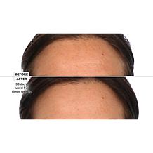 Active Argan Resurface Accelerating Peel