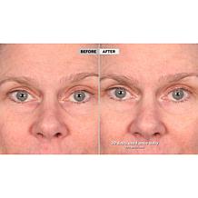 Active Argan Resurface Super Size Resurfacing Serum Auto-Ship®