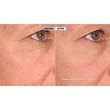 Active Argan Resurface Super Size Resurfacing Serum