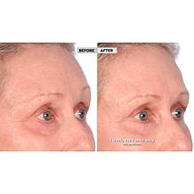 Active Argan Resurface Super Size Resurfacing Serum