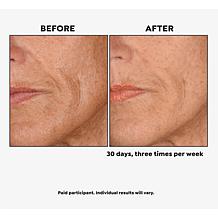 "As Is" BeautyBio GloPRO Skin Tool for Face & Body