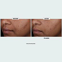 "As Is" Sharper Image Revel LED Light Therapy Face Mask