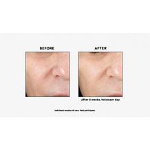 BeautyBio 2-pack ZenBubble Gel Moisturizer