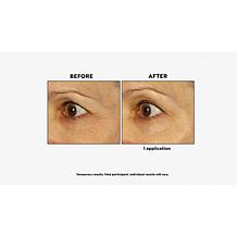 BeautyBio GloPRO Tool & Eye Head Ultimate Cream & 5 Eye Gels