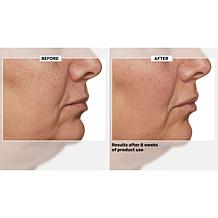 Beekman 1802 Milk RX Advanced Better Aging Renexosome Cream AS