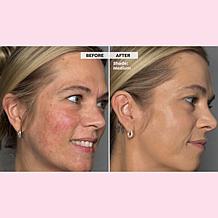 Doll 10 Peptide Bounce Foundation with Brush, Mascara and Bag Set