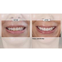 Intelliwhite 14-pack Ultra HAP+ Whitening Strips Auto-Ship®