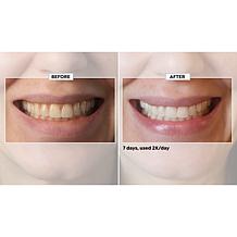 Intelliwhite 14-pack Ultra HAP+ Whitening Strips