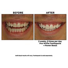 intelliWHiTE | Shop Teeth Whitening Kits, Toothpaste & Toothbrushes | HSN