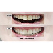 Intelliwhite Fusion 2-in-1 Whitening Serum Kit