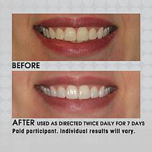 IntelliWHITE® Platinum Pen Whitening Duo w/Mouth Guard