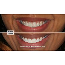 Intelliwhite Platinum Pen Whitening Kit with Turbo Boost