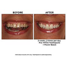 IntelliWHiTE® Power Boost Daily Whitening Gel Duo