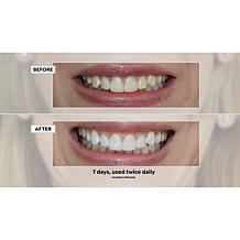 Intelliwhite Prostrips 14-Treatment Coconut Teeth Whitening Kit AS