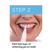 Intelliwhite TRIPULSE Teeth Whitening System