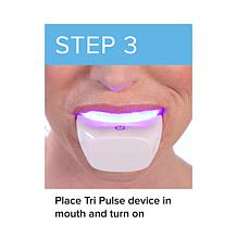 Intelliwhite TRIPULSE Teeth Whitening System