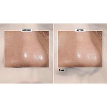 Isomers 14% Azelaic Acid Booster Complex