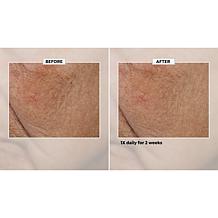 Isomers Accelerated Recovery Treatment Serum