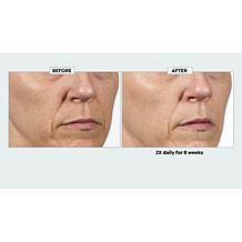 Isomers Retiniacin Night Renewing Treatment Serum