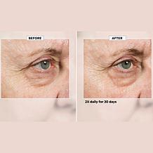 Isomers Skincare Fast Lift Eye Serum Set