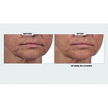 Isomers Skincare Matrixyl Hydration Boost Cream