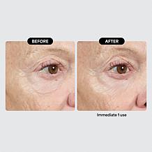 Isomers Skincare Special Edition Matrixyl Peptide Holiday Gift Set