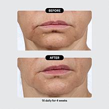 Isomers Skincare Special Edition Problem Solvers Holiday Gift Set