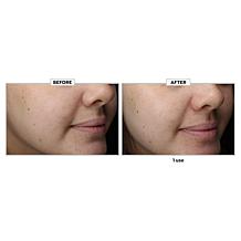 Kate Somerville ExfoliKate Exfoliating Treatment