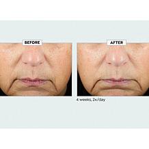 Kate Somerville KateCeuticals SuperCell Serum