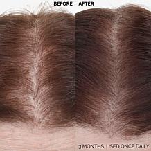 Keranique 120 Day Hair Regrowth Foam Bundle