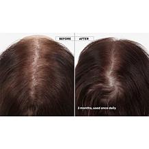 Keranique 120-Day Hair Regrowth Foam System with Scalp Massager