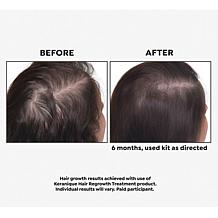Keranique 90-Day Hair Regrowth Volumizing Kit