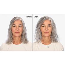 Keranique Hair Regrowth 60-Day Treatment w/ Scalp Massager Auto-Ship®