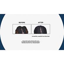 Keranique Hair Volumizing & Strengthening Kit