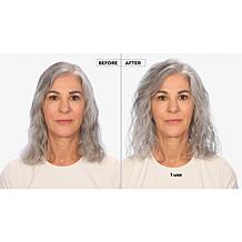 Keranique Lift & Repair Treatment Spray 3.4oz - 2-pack