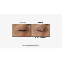 Korres 2-piece Black Pine Face & Eye Serum Set
