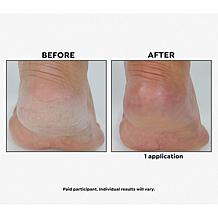 Korres Elasti-Smooth™ Mega Size Guava Mango Body Butter