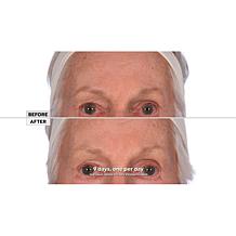 Korres White Pine Meno-Reverse Concentrate