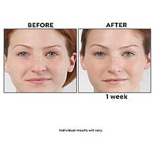 Korres Wild Rose Vitamin C Serum