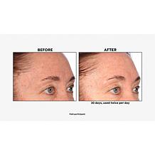 Lancôme Genifique Concentrate with Deluxe Sample Auto-Ship®