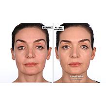 Lancôme Renergie Lift Foundation