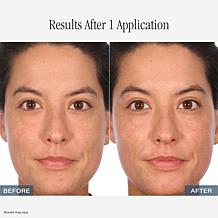 LUM OIL+LUMLIPOIL AS