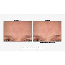 M. Asam Resveratrol NT50 Essence of Youth Serum Auto-Ship®