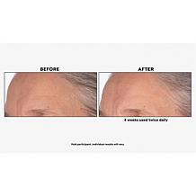 M. Asam Resveratrol NT50 Essence of Youth Serum Auto-Ship®