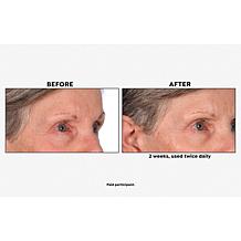 M. Asam VinoLift Skin Tightening Eye Balm 1.01 fl. oz.