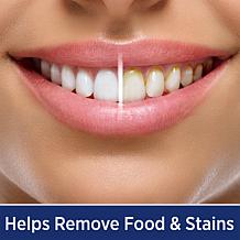 Miracle Smile Deluxe Pro Water Flosser with 10 Flossing Heads