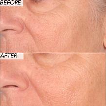 Nakery Beauty 2-Piece Supersize Firm + Lift Collection - Auto-Ship®